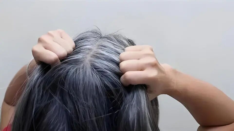 一针告别白发？揭秘“白发针”的真相